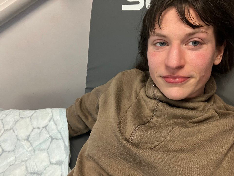 A Green Party local election candidate has had one of her fingers bitten off by a dog