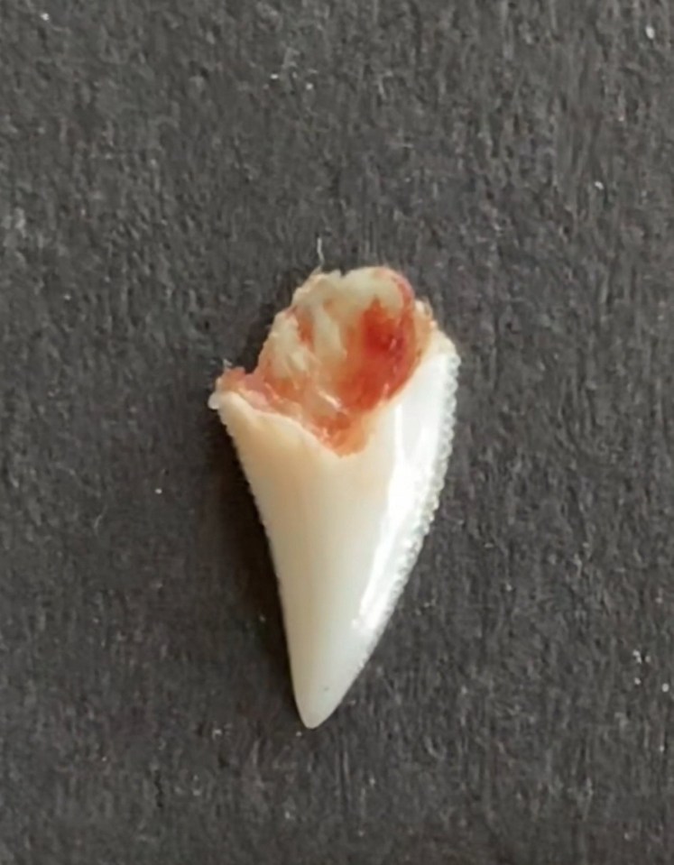 The tooth of tha shark that bit Angus. A man survived a shark attack - and is getting the teeth left embedded in his arm turned into jewellery. Angus Kockott, 20, was out snorkelling in the shallow water off the island of Mangareva, French Polynesia. Out of nowhere, a 2.5m shark approached him from behind a reef - and clamped its jaws on his arm. Quick-thinking Angus pulled a knife - used for cutting diving lines - from his pocket and stabbed the shark WHERE before swimming to safety.