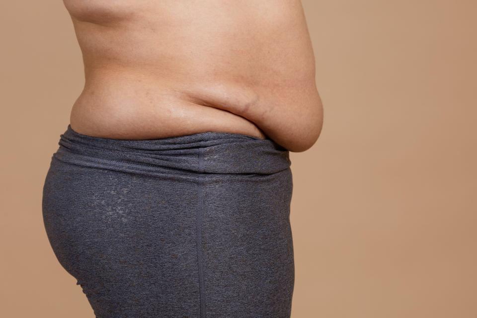 Side view of a woman's overweight abdomen.
