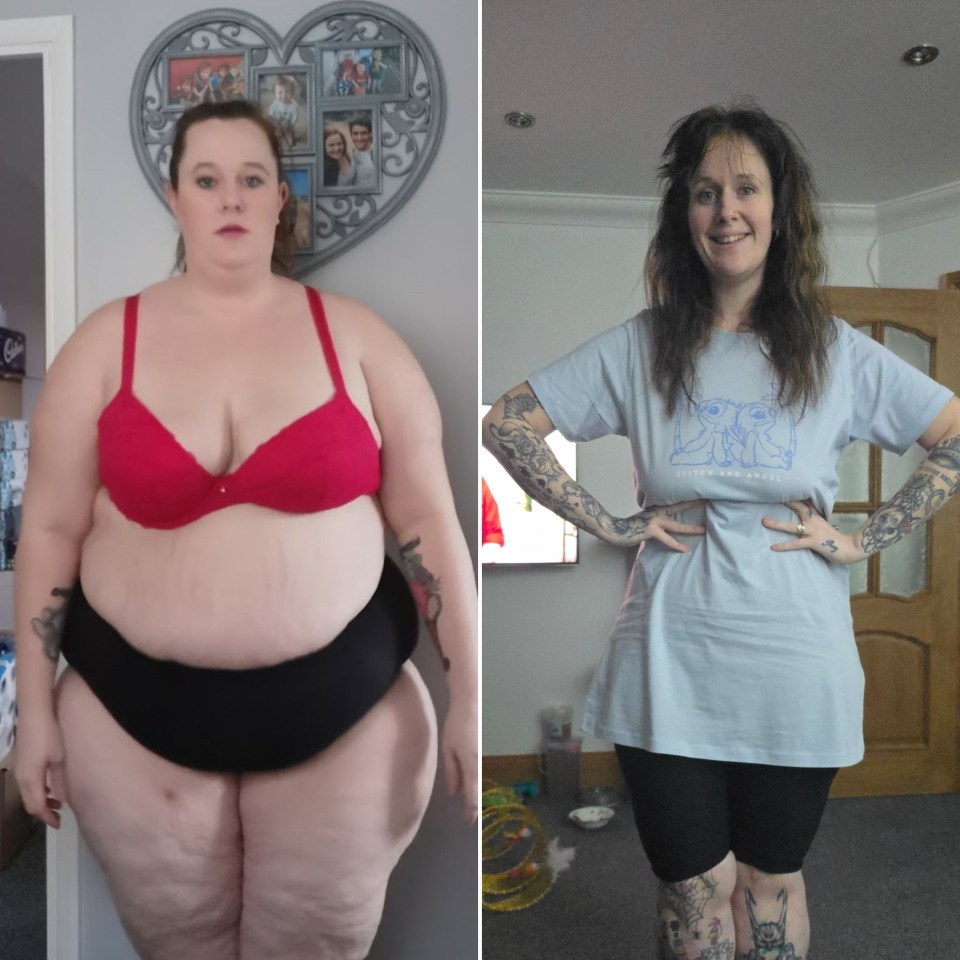 Before and after photos of a woman who lost significant weight.