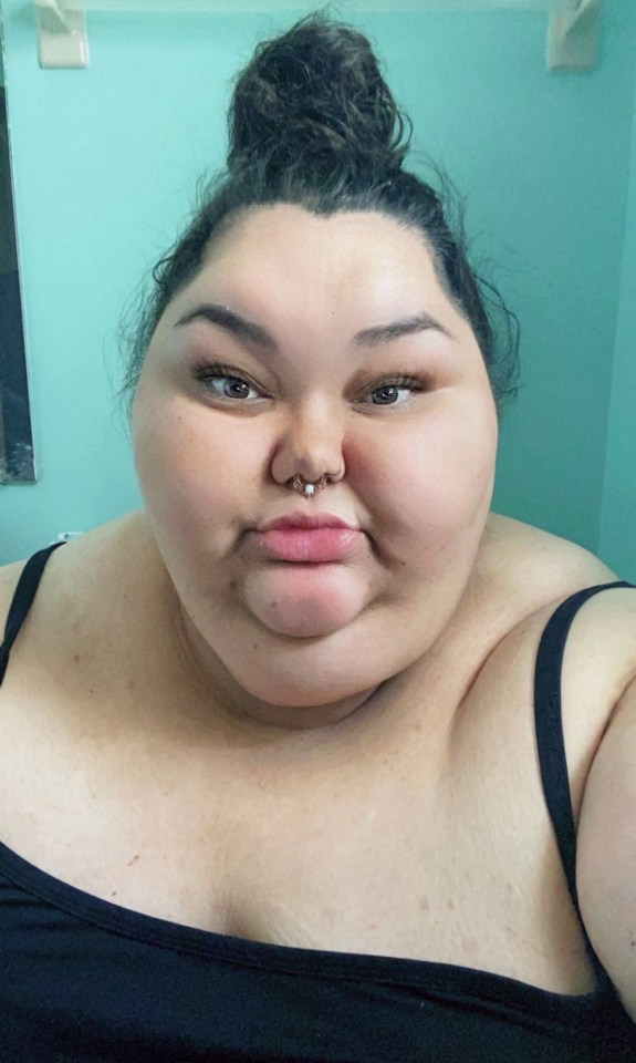 Woman before weight loss.