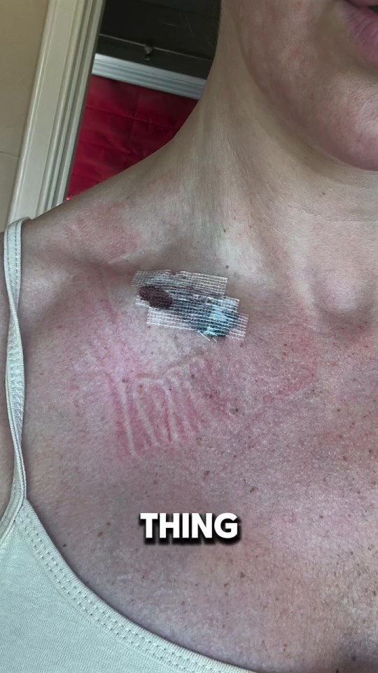 Close-up photo of a bandage on a person's chest.
