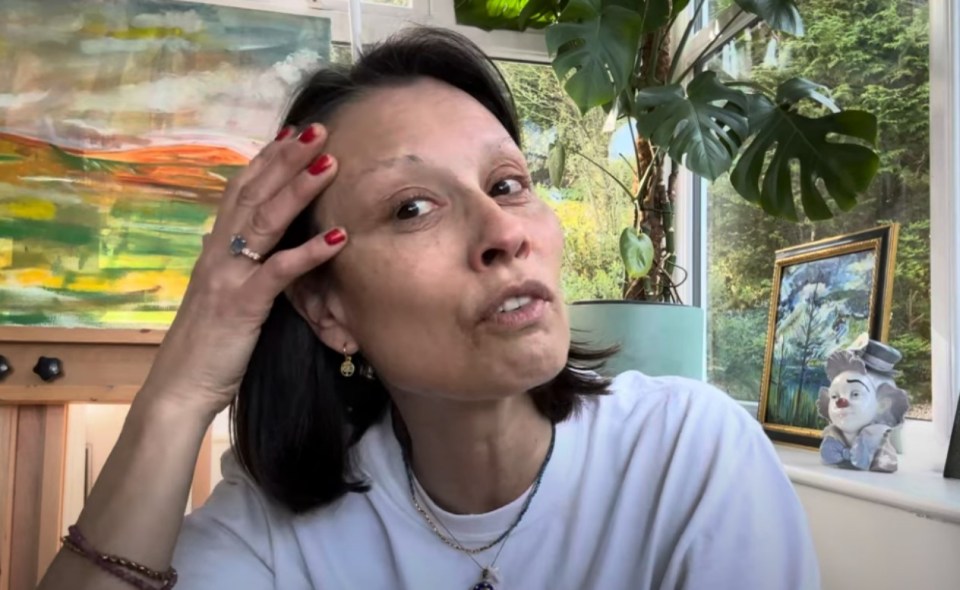Woman discussing her alopecia.