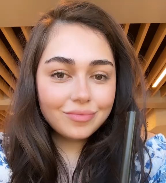 Woman after 60lb weight loss, showing her "Ozempic face."