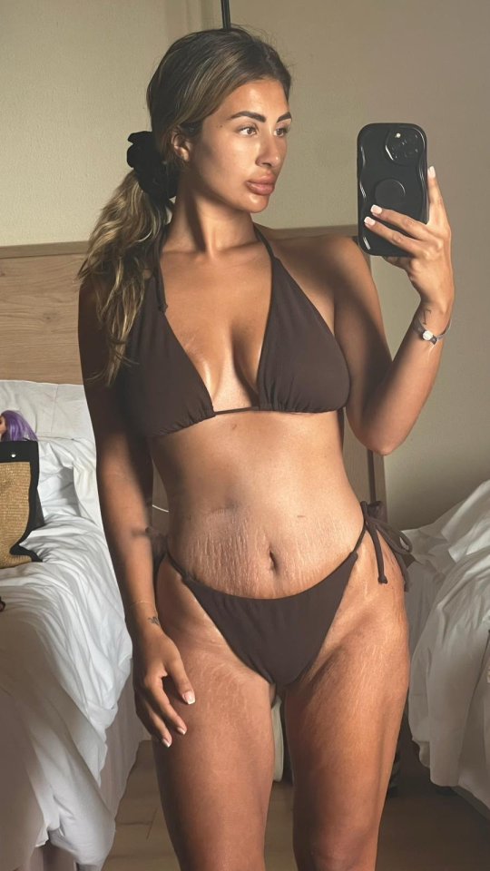 Sofia Alessia after weightloss surgery. A woman who forked out £10k on weight loss surgery was left throwing up lumps of flesh but says ''it was all worth it for the glow up''. Sofia Alessia, 27, piled on the pounds after and during her first pregnancy and went from size 10 to a size 16. After tipping the scales at 16 stone, she tried the gym after and running but struggled due to ''emotional eating'' and decided surgery was her best bet. While researching online, Sofia decided against going to Turkey for cheap surgery, after hearing ''horror stories''.