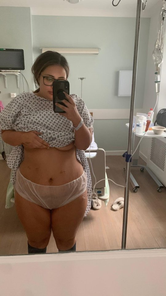 Woman in hospital gown after weight loss surgery.